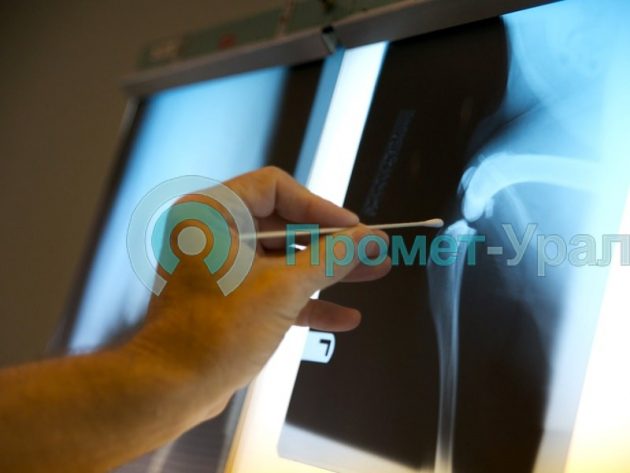 Проявка рентгенологических снимков: особенности процедуры