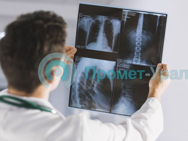 Рентгеновские исследования в травматологии